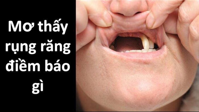 Mơ thấy rụng răng đánh con gì?